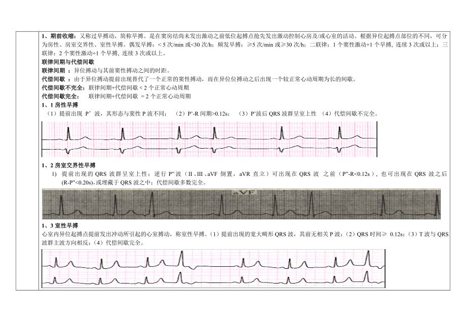 ICU学习计划心电图5月.doc_第3页