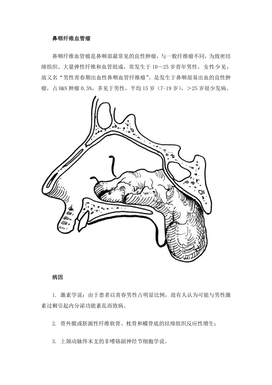 鼻咽纤维血管瘤.doc_第1页