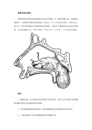 鼻咽纤维血管瘤.doc