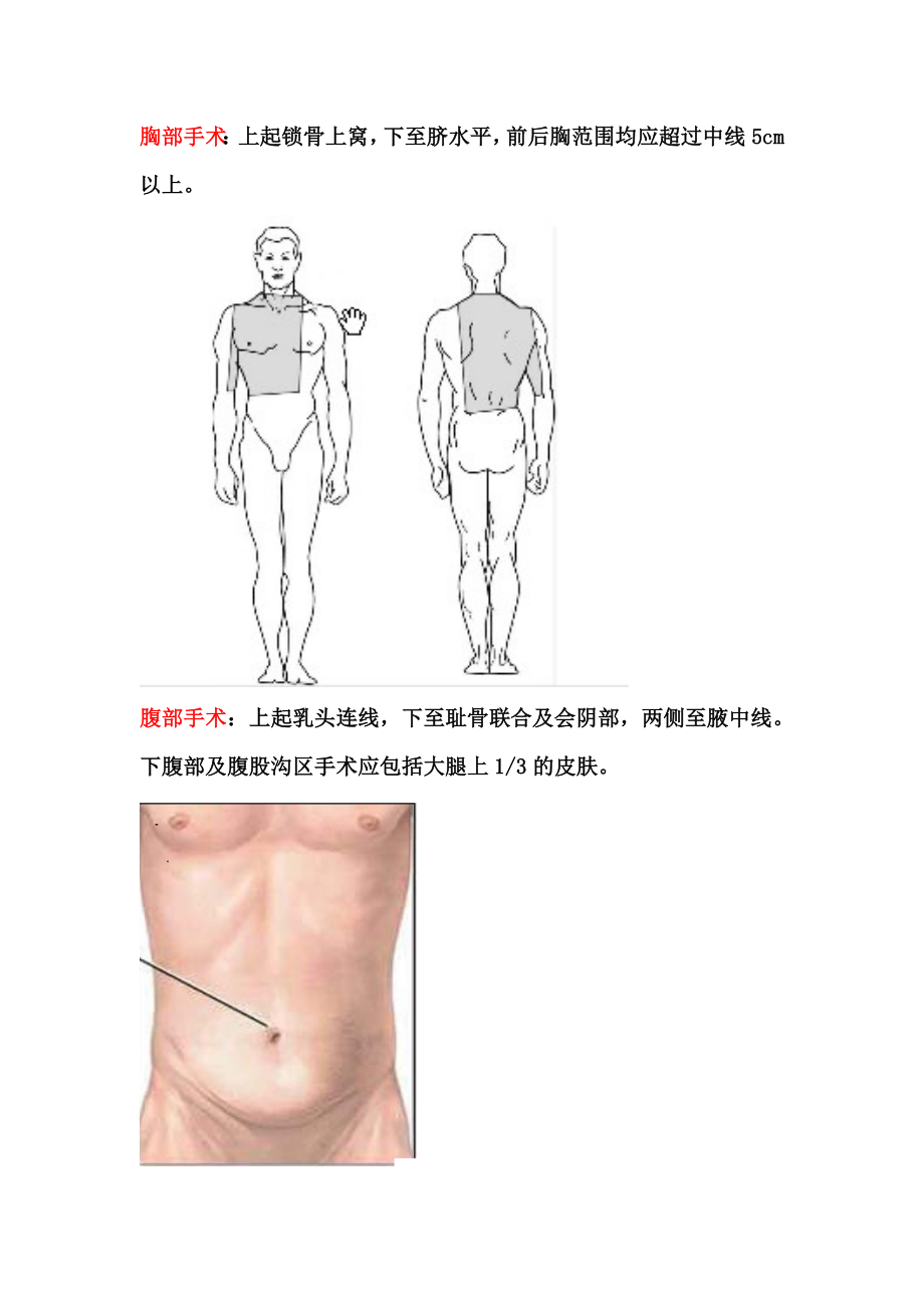 外科备皮范围.doc_第2页