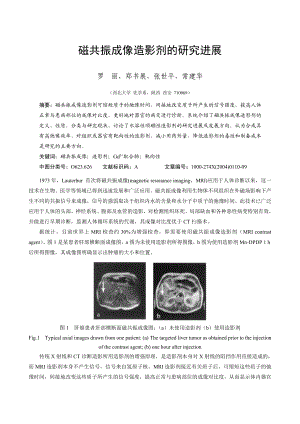 磁共振成像造影剂的研究进展.doc