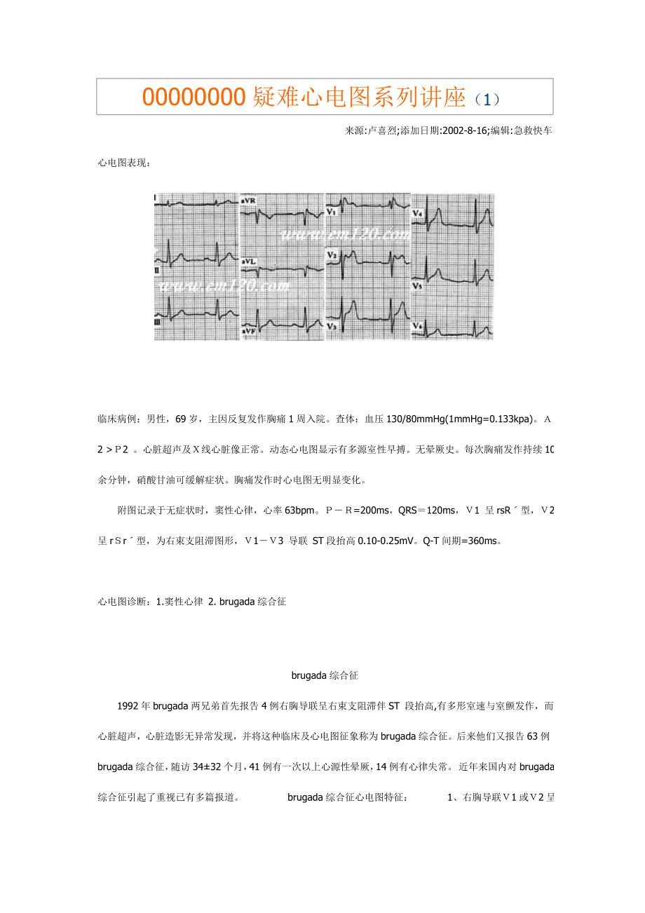 疑难心电图系列讲座.doc_第1页