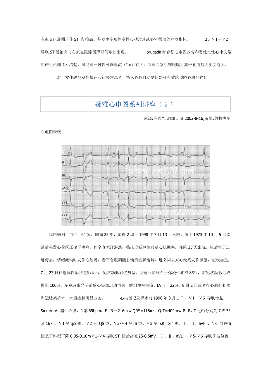 疑难心电图系列讲座.doc_第2页