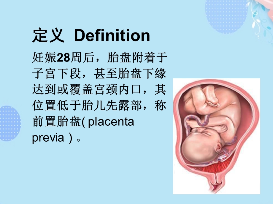 妇产科学精品前置胎盘PPT资料(完整版)课件.ppt_第2页