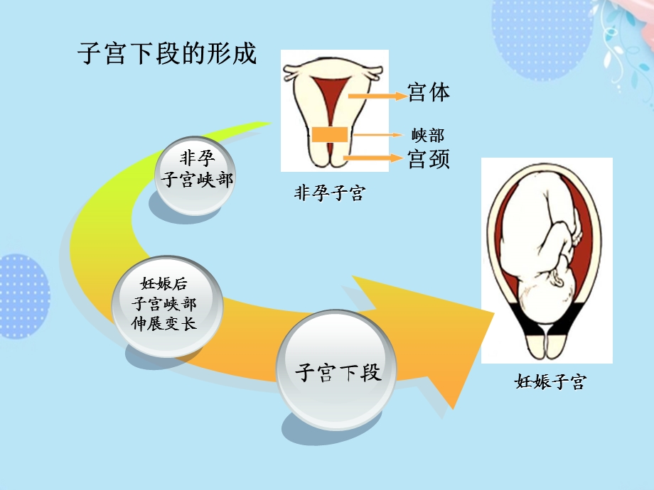 妇产科学精品前置胎盘PPT资料(完整版)课件.ppt_第3页