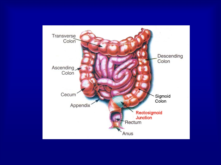 外科学ppt课件： 结直肠.ppt_第3页