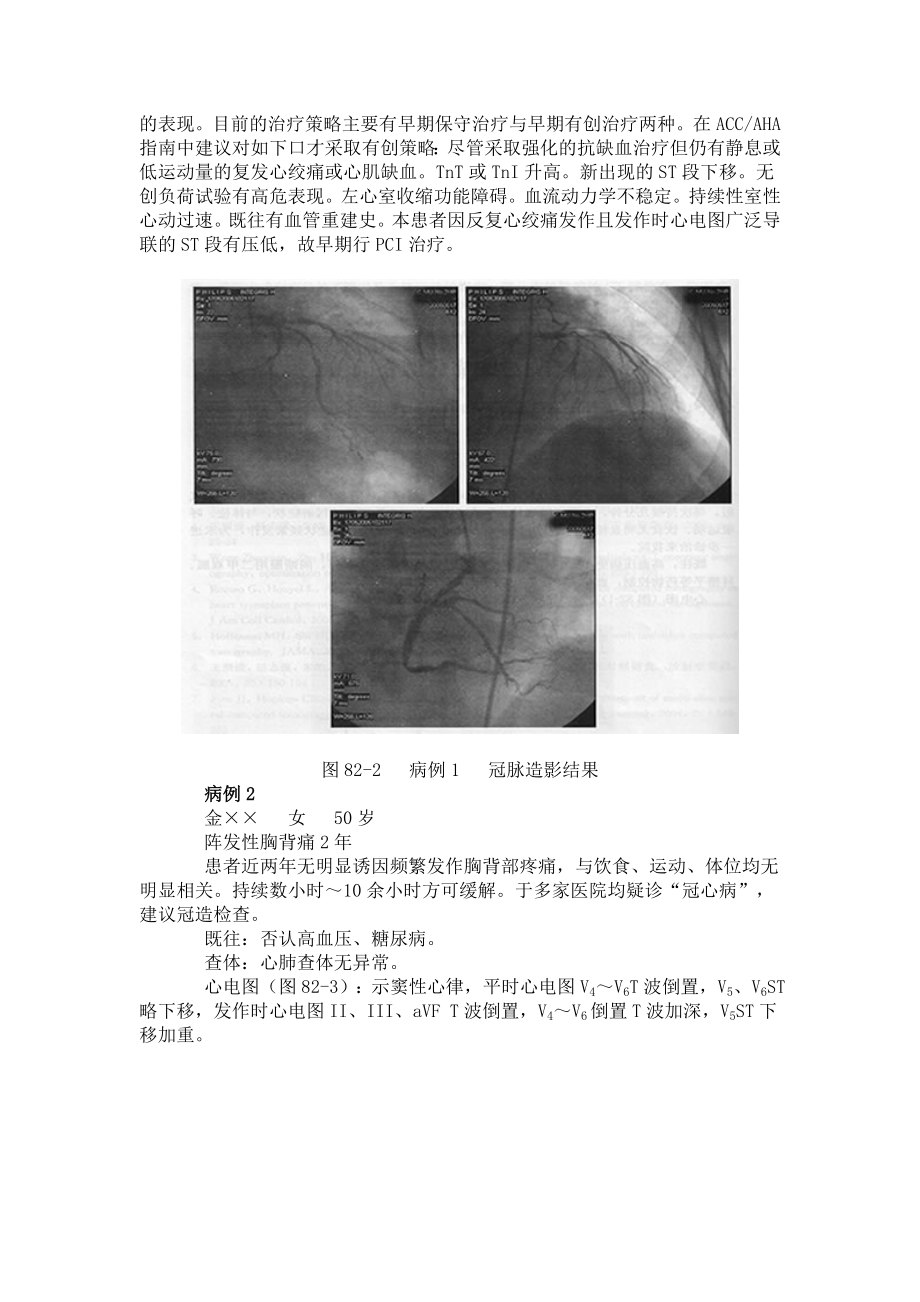 不典型胸痛病例分析.doc_第2页