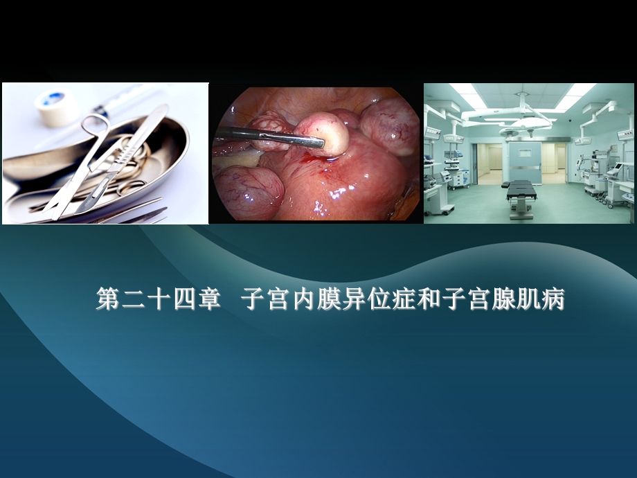 妇产科学第二十四章 子宫内膜异位症和子宫腺肌病 课件.ppt_第1页