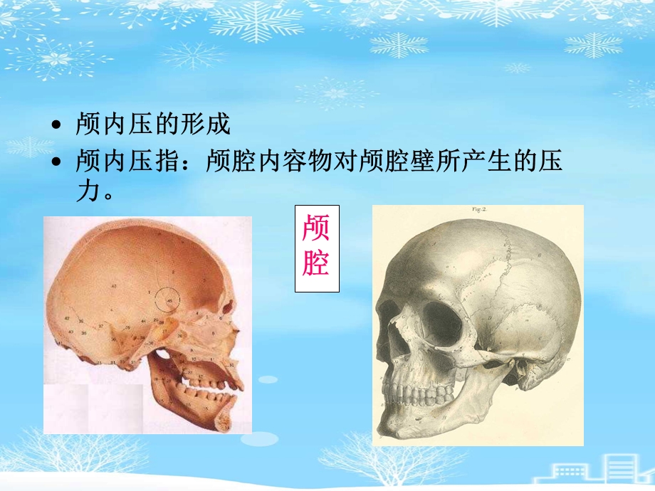 颅内压增高患者的护理2021完整版课件.ppt_第3页