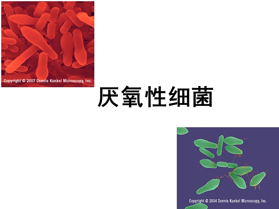 厌氧性细菌分析课件.ppt_第1页