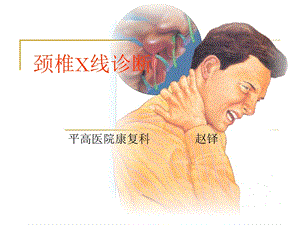 颈椎X线诊断讲解课件.ppt