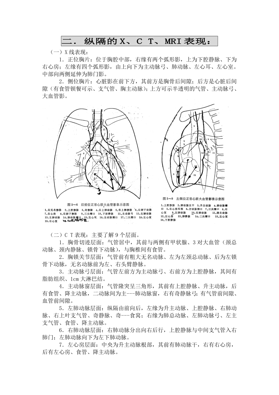 医院纵隔肿瘤的影像诊断.doc_第3页