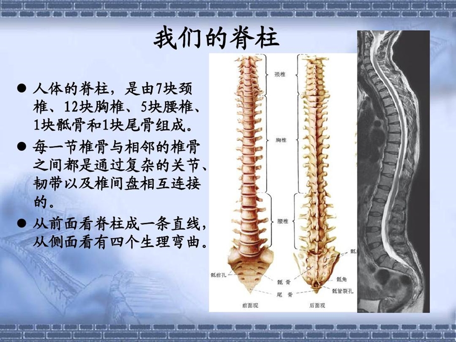 颈椎、腰椎CT常见病变课件.ppt_第2页