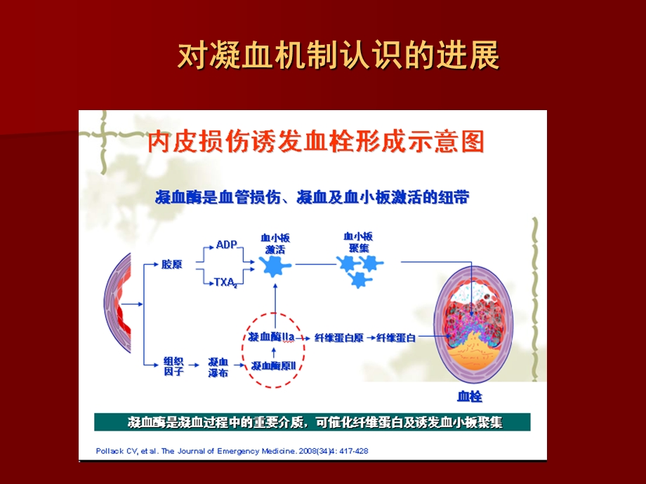 围术期抗栓治疗处理对策课件.ppt_第2页