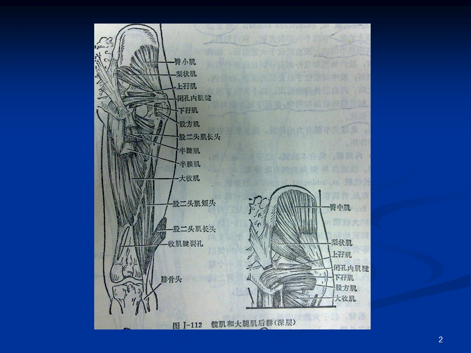 骨盆肌肉MRI解剖课件.ppt_第2页