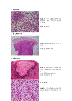 病理切片整理.doc