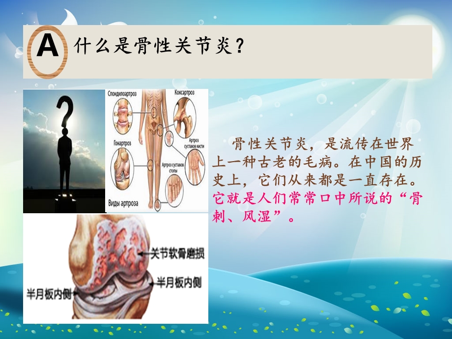 骨性关节炎科普宣传ppt课件.ppt_第1页