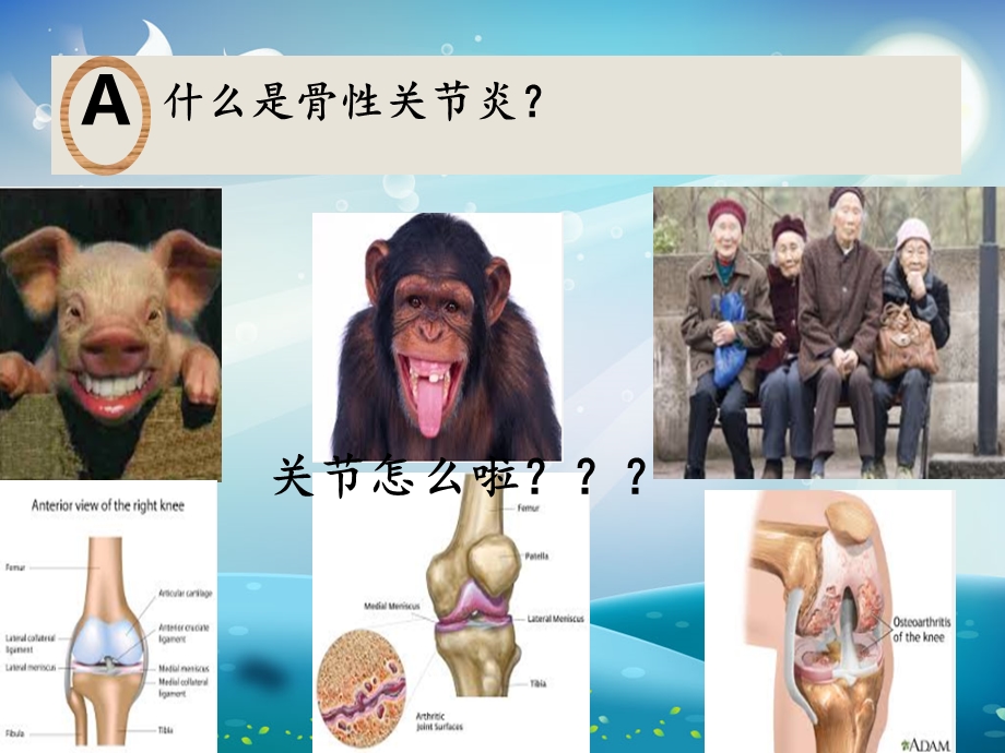 骨性关节炎科普宣传ppt课件.ppt_第3页