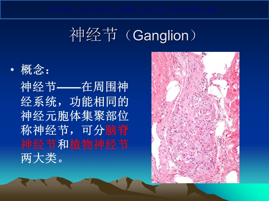 嗜铬细胞瘤影像ppt课件.ppt_第2页