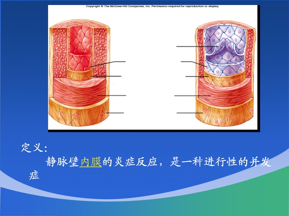 静脉炎专业知识讲座讲义课件.ppt_第3页