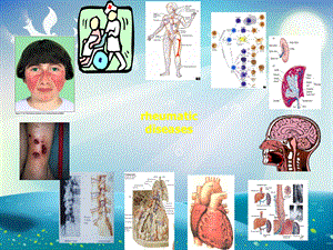 风湿性疾病的实验诊断ppt课件.ppt