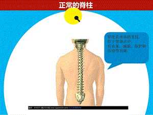 预防脊柱侧弯课件.ppt