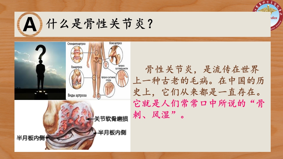 骨性关节炎科普宣传 课件.ppt_第2页