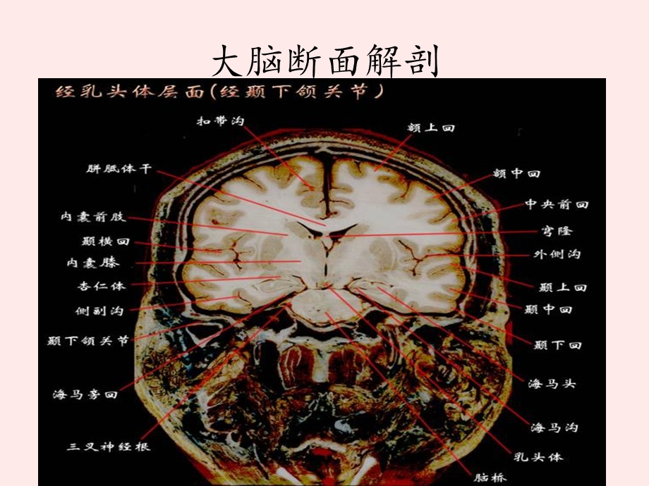 大脑结构图图例课件.ppt_第2页