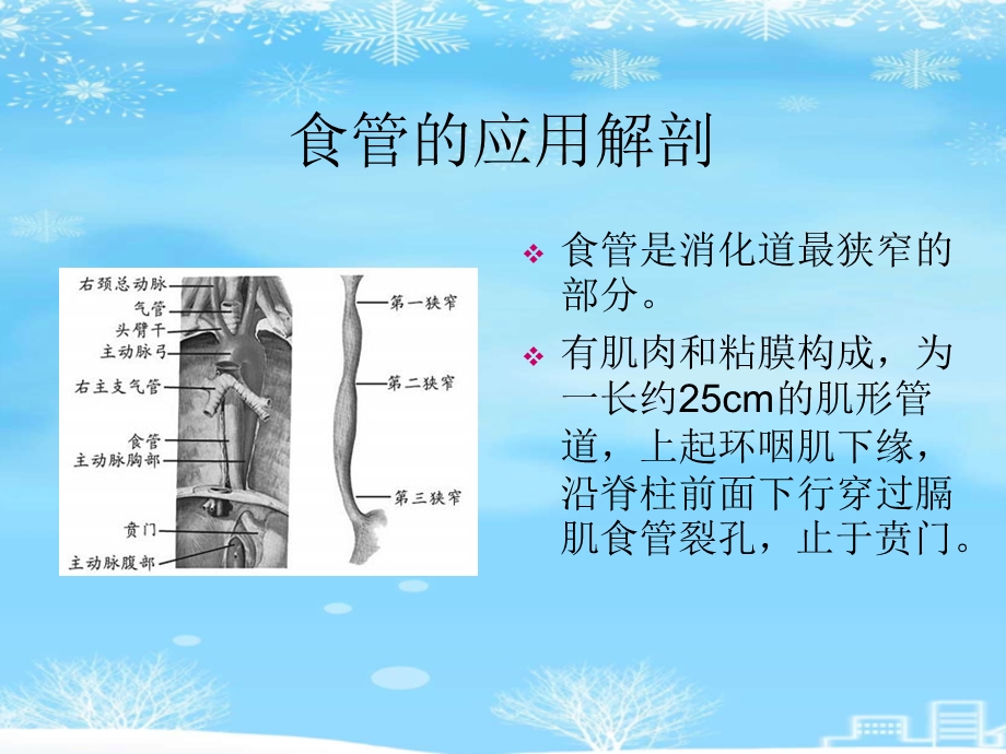 食管异物的护理2021完整版课件.ppt_第3页