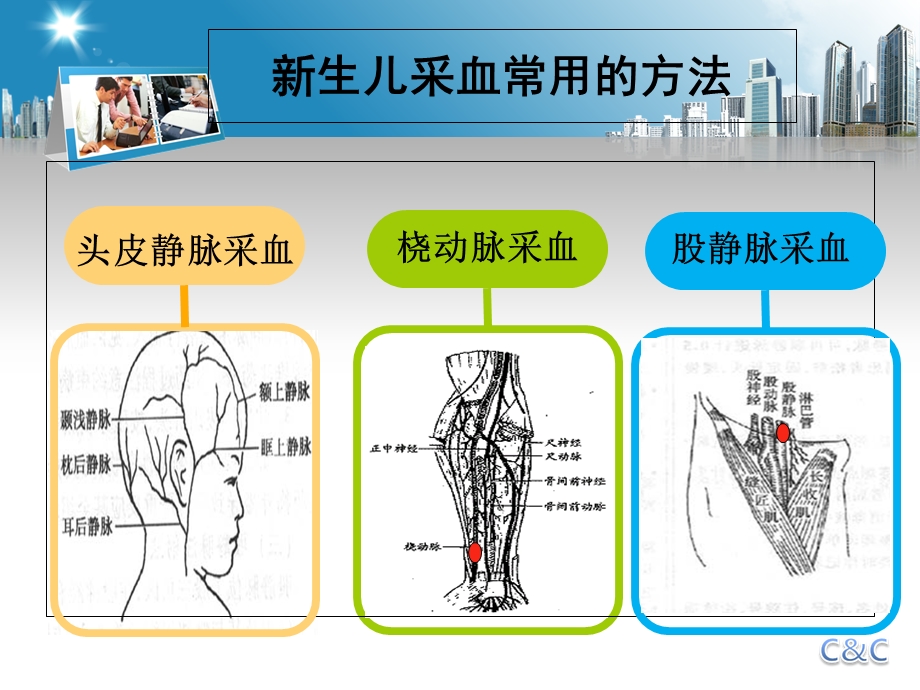 医学新生儿股静脉采血培训ppt课件.ppt_第3页