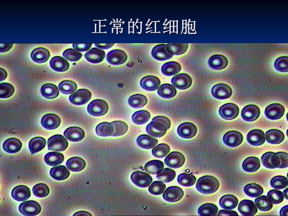 医学：显微镜细胞形态分析课件.ppt_第3页