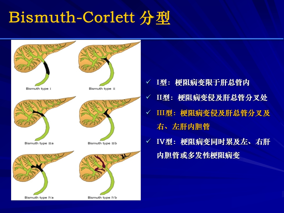 医学交流ppt课件：高位恶性胆道梗阻粒子支架临床应用研究.pptx_第3页