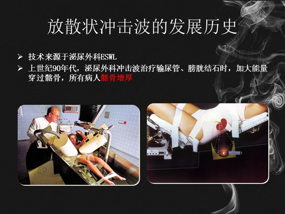 医学放散状冲击波的临床应用培训ppt课件.ppt_第3页