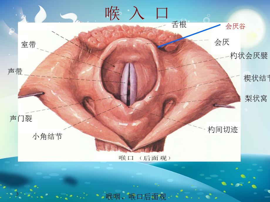 喉癌护理查房ppt课件.ppt_第3页