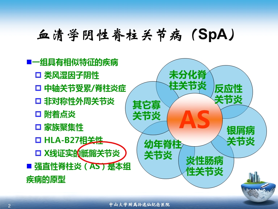 医学影像 SpA骶髂关节炎的影像学诊断与鉴别诊断课件.ppt_第2页