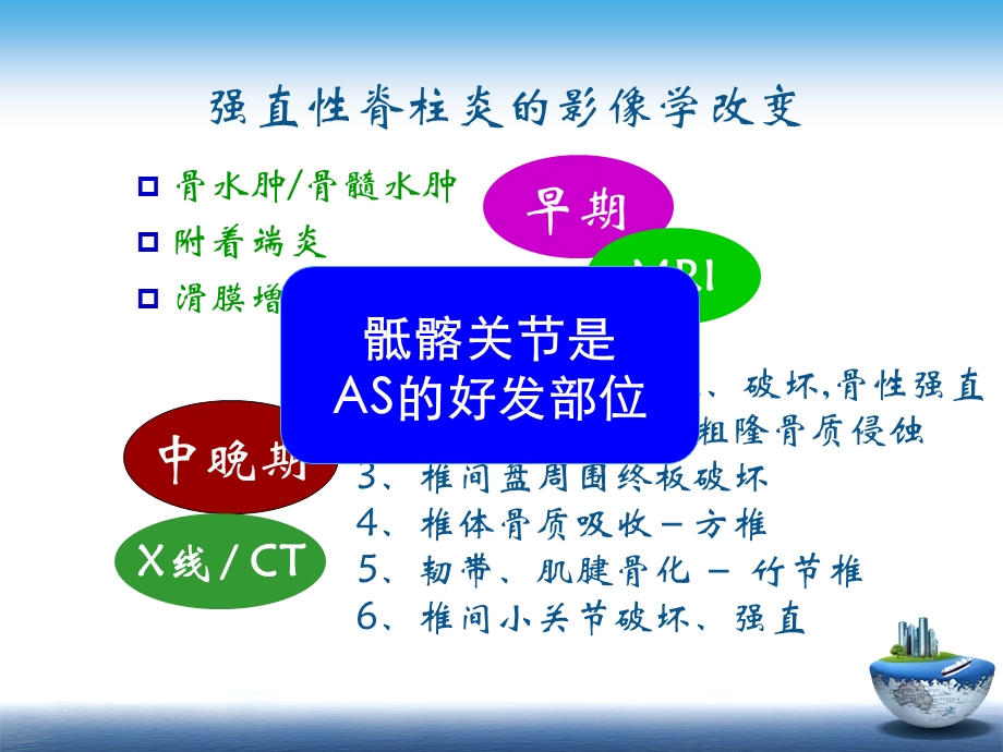 医学影像 SpA骶髂关节炎的影像学诊断与鉴别诊断课件.ppt_第3页