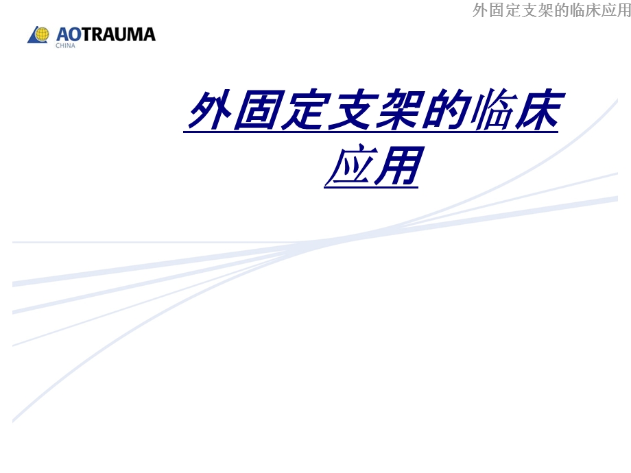 外固定支架的临床应用讲义课件.ppt_第1页