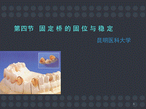 固定桥的固位与稳定PPT课件.ppt