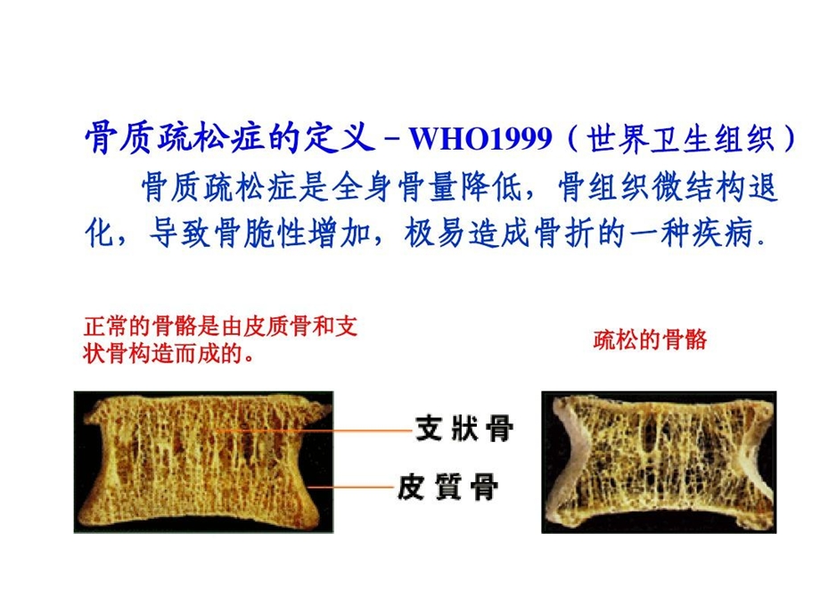 骨代谢血清标志物课件.ppt_第3页