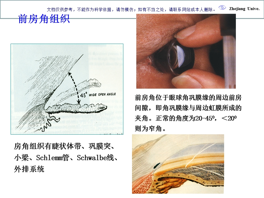 青光眼专业知识ppt课件.ppt_第3页