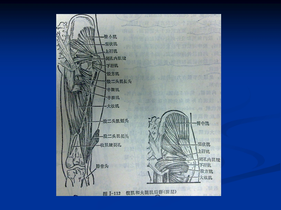 骨盆肌肉MRI解剖讲义课件.ppt_第2页