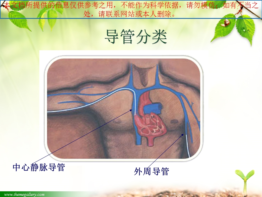 静脉留置针的临床应用培训ppt课件.ppt_第2页