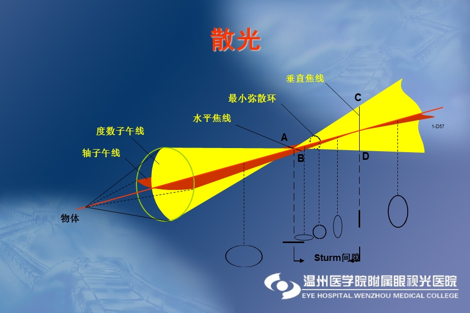 医学教学ppt课件：散光硬性角膜接触镜.ppt_第3页