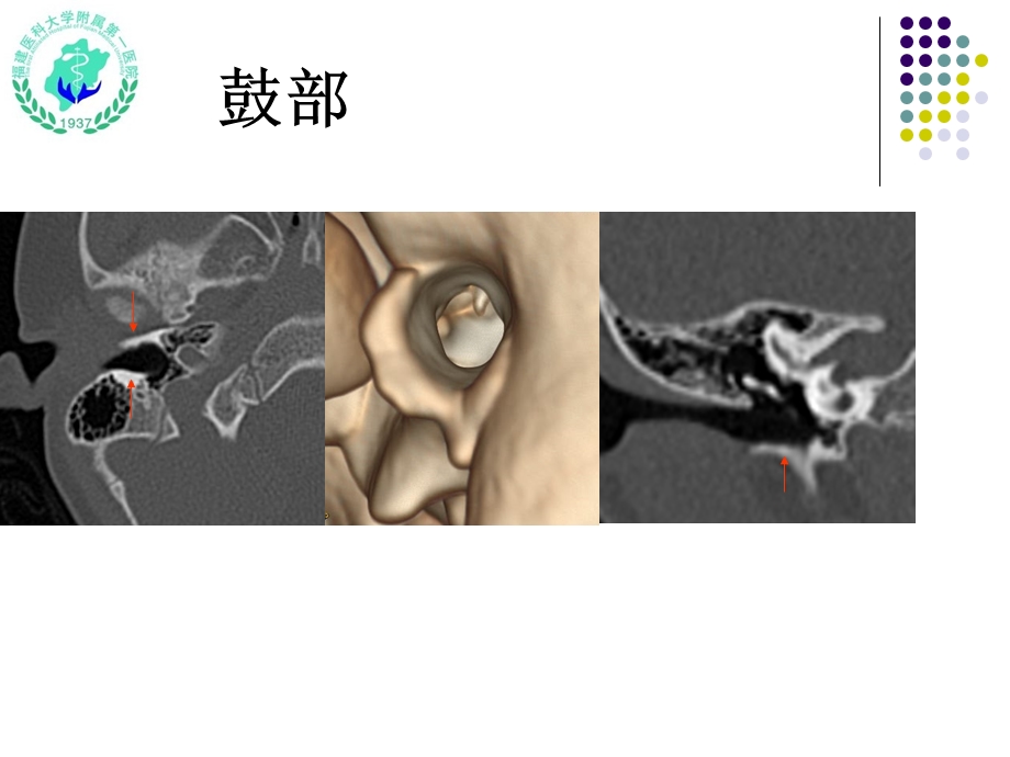 医学ppt课件耳颞部影像解剖.ppt_第3页