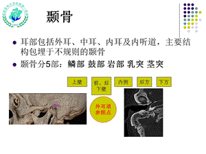 医学ppt课件耳颞部影像解剖.ppt