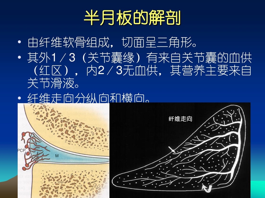 半月板损伤标准课件.ppt_第3页