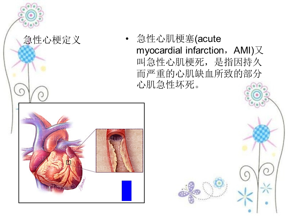 医学ppt课件急性心梗急诊行PCI术中配合.ppt_第1页