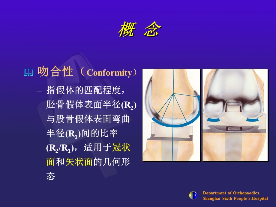 医学ppt课件全膝关节假体设计和选择.ppt_第2页