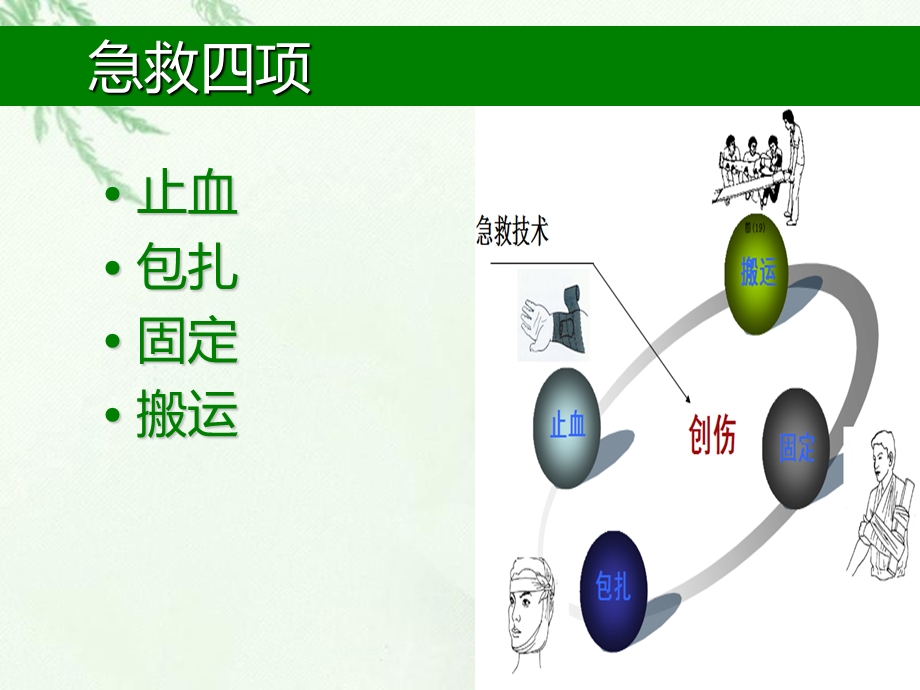 急救四项之止血和包扎2021完整版课件.ppt_第2页