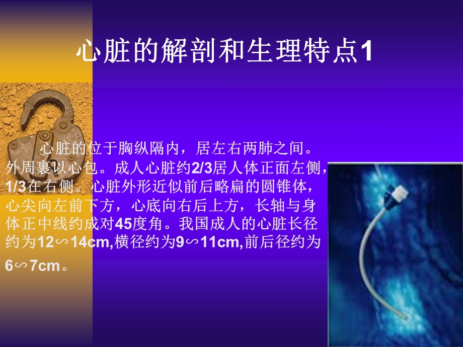 心脏超声解剖ppt课件.ppt_第2页